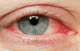 eye cosmetic surgery