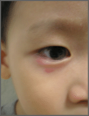 eye cream